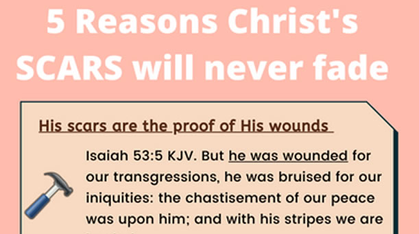 5 Reasons Christ’s Scars Will Never Fade